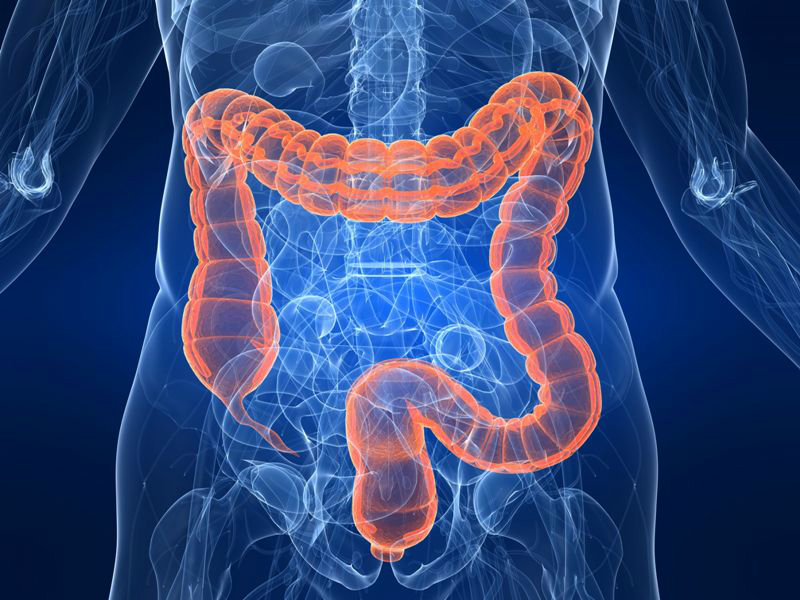 Hereditary nonpolyposis colorectal cancer